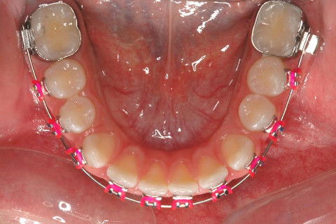 Haas Multifunção 3d, Modificado por Franco E.j