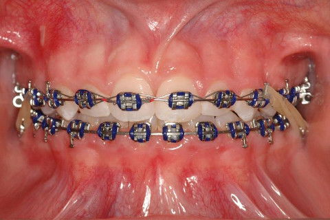 Haas Multifunção 3d, Modificado por Franco E.j