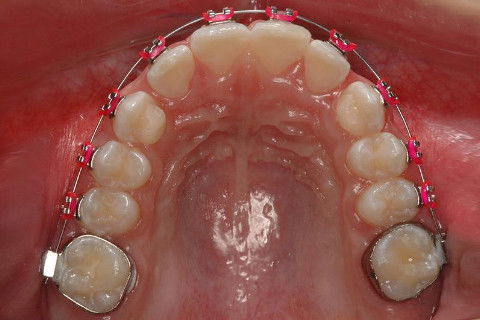 Haas Multifunção 3d, Modificado por Franco E.j
