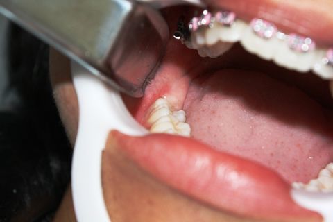 Visão clinica elem. 48