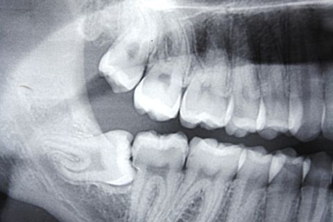 aspecto radiográfico