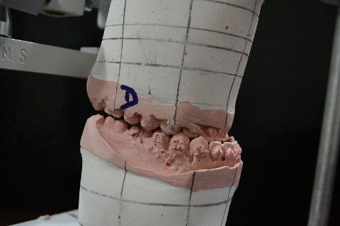 Modelo em Articulador