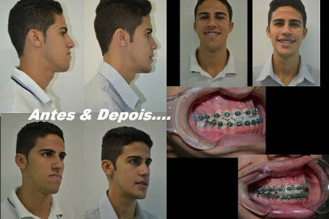 Antes & Depois....