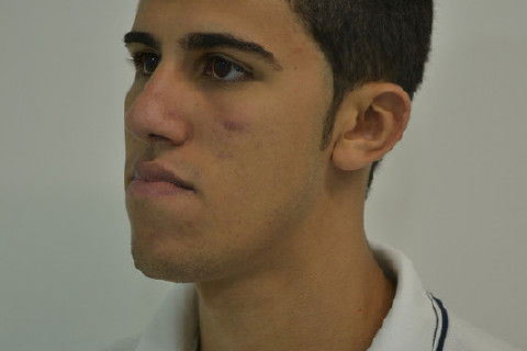 Diagonal pré operatório