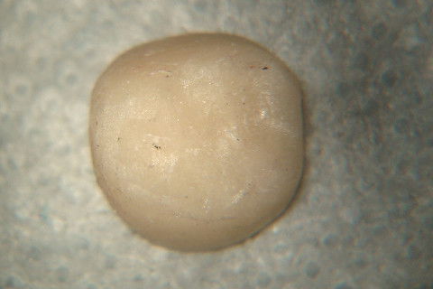 Retratamento de Canal, Tratamento de Perfuração, Restauração Provisória com Resina, Núcleo e Provisório.