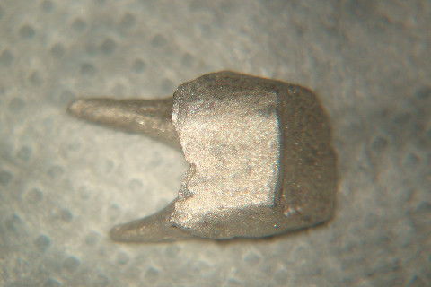 Retratamento de Canal, Tratamento de Perfuração, Restauração Provisória com Resina, Núcleo e Provisório.