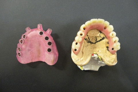 Protocolo Inferior e Superior com Cirurgia Guiada por Computador
