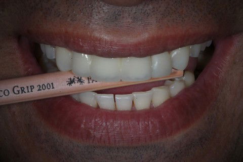 Ensaio fotográfico após finalização do caso.