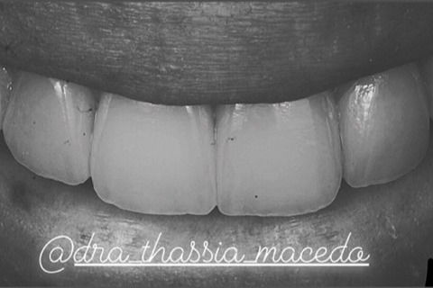 Fotografia em preto e branco para verificar detalhes.