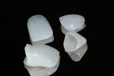 Perfeição nos detalhes.