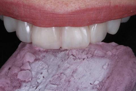 Acabamento e polimento, finalizando com ensaio fotográfico.