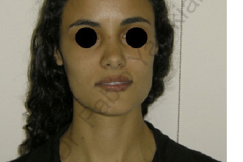 Foto facial frontal final