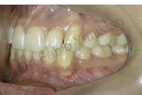 Foto lateral esquerda final