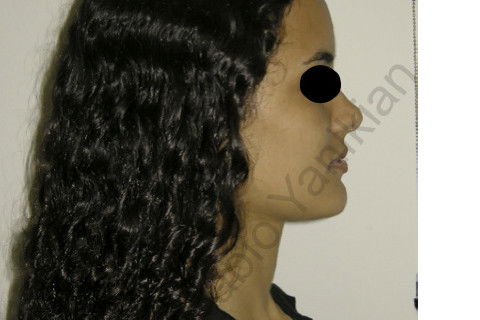 Foto facial perfil final