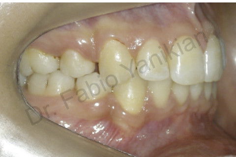 Foto lateral direita final