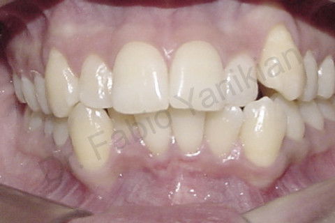 Foto frontal inicial