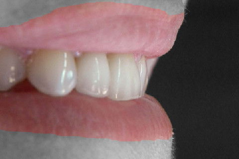 FOTO ARTISTICA PARA VALORIZAR O RESULTADO FINAL