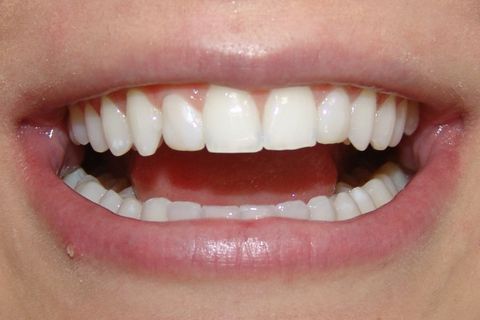 Clínica Odontológica M & M Dentalli - Dr. Maurício Spillere Santos - Foto Final 1.2