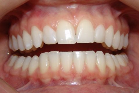 Clínica Odontológica M & M Dentalli - Dr. Maurício Spillere Santos - Foto Final 1.1