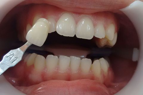 Registro de cor (A1)