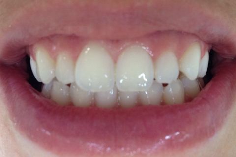 Resultado final do caso