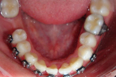 BRUNO ECCHER Ortodontia