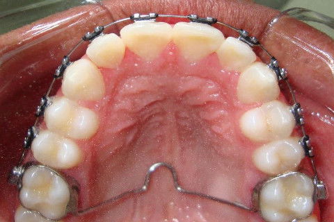 BRUNO ECCHER Ortodontia