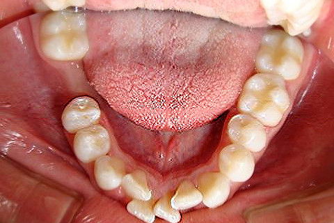 BRUNO ECCHER Ortodontia