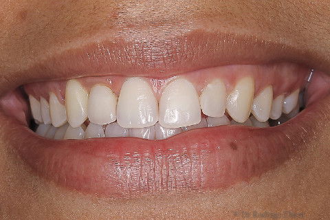 Sorriso da paciente.