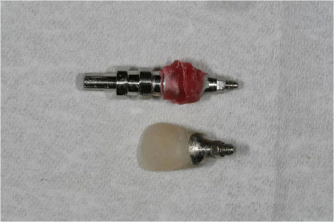 Personalização do transferente.