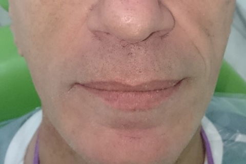 Aspecto final de frente