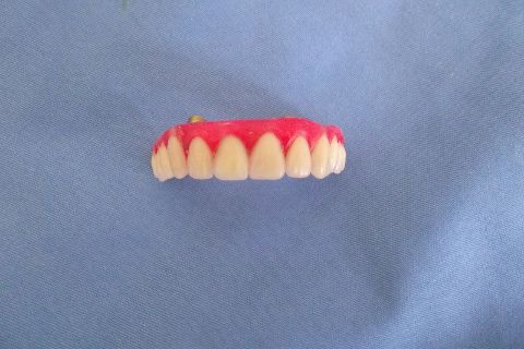 Protocolo Duplo Sendo Superior All-On-4