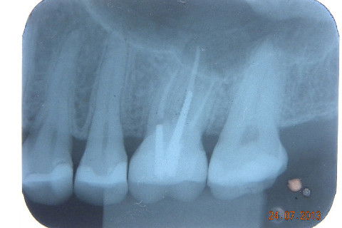 FOTO DE OUTRO CASO IGUAL. Até radiograficamente existe o 
