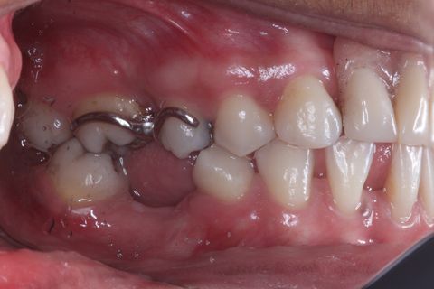 Foto Perfil (uso de espelho). Lado esquerdo