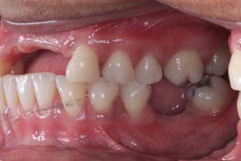 Foto perfil aproximada.