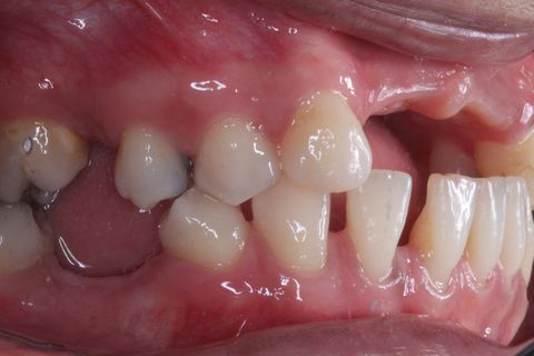 Foto perfil aproximada.