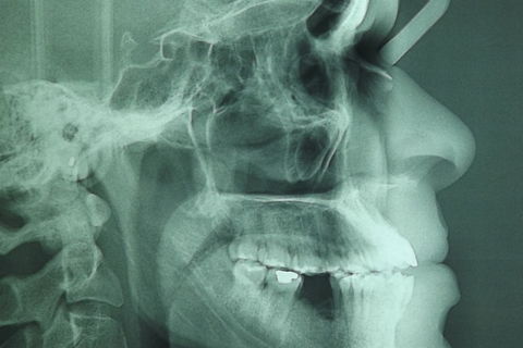 fotos iniciais do caso.