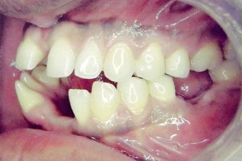 fotos iniciais do caso.