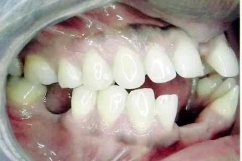 fotos iniciais do caso.