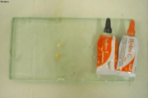 Hidro-C para cimentação da provisória