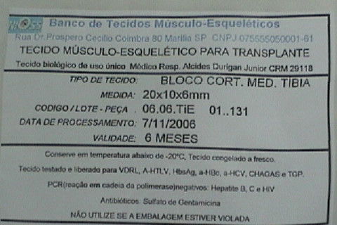 Embalagem do tecido ósseo do Banco de Ossos da UNIOSS