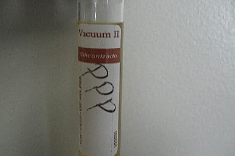 Plasma Pobre em Plaquetas, tambem conhecido por PRF, utilizado para cobrir o enxerto e melhorar a cicatrização dos tecidos moles