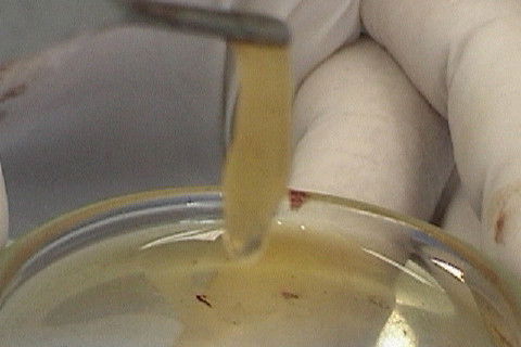 Geleificação do plasma pobre em plaquetas