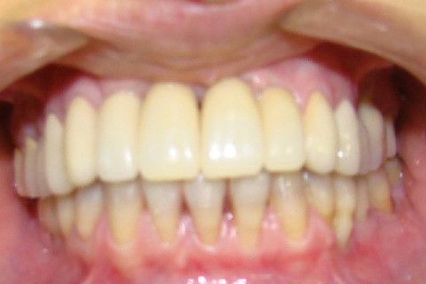 Retorno da paciente após o tratamento ortodontico