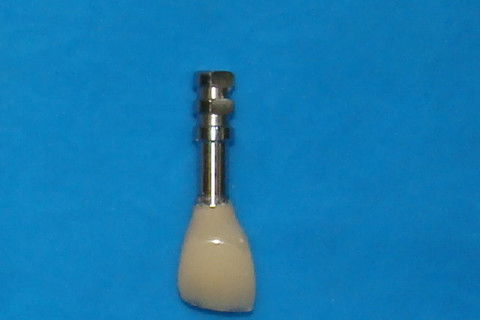 Coroa temporária presa ao analogo do implante