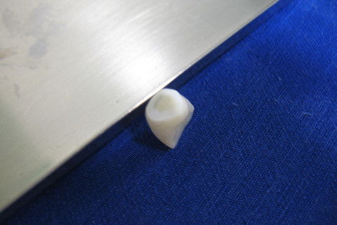 Dente preparado.