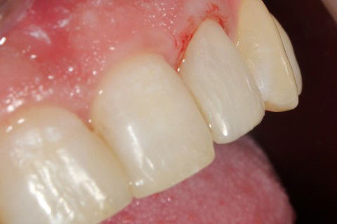 Aguardando retorno para finalizar o polimento