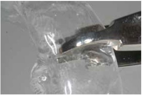 Ativando por vestibular na região interproximal