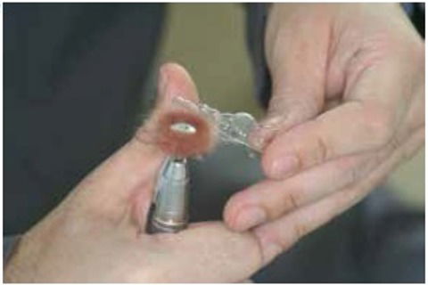 Polimento com rodinhas scotch-brite