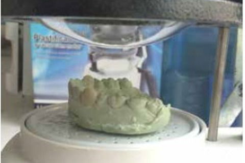 Ponto do aquecimento do plástico Essix Ace 0.35